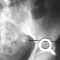 thumbnail of x-ray image